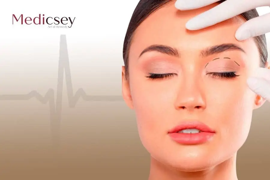 oculoplastic surgery in Turkey