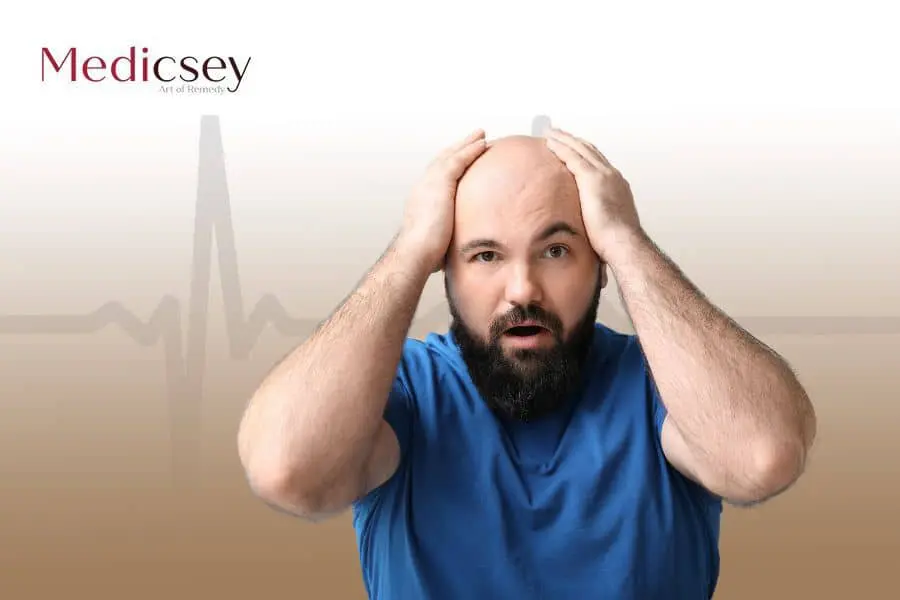 hair loss treatment in Turkey