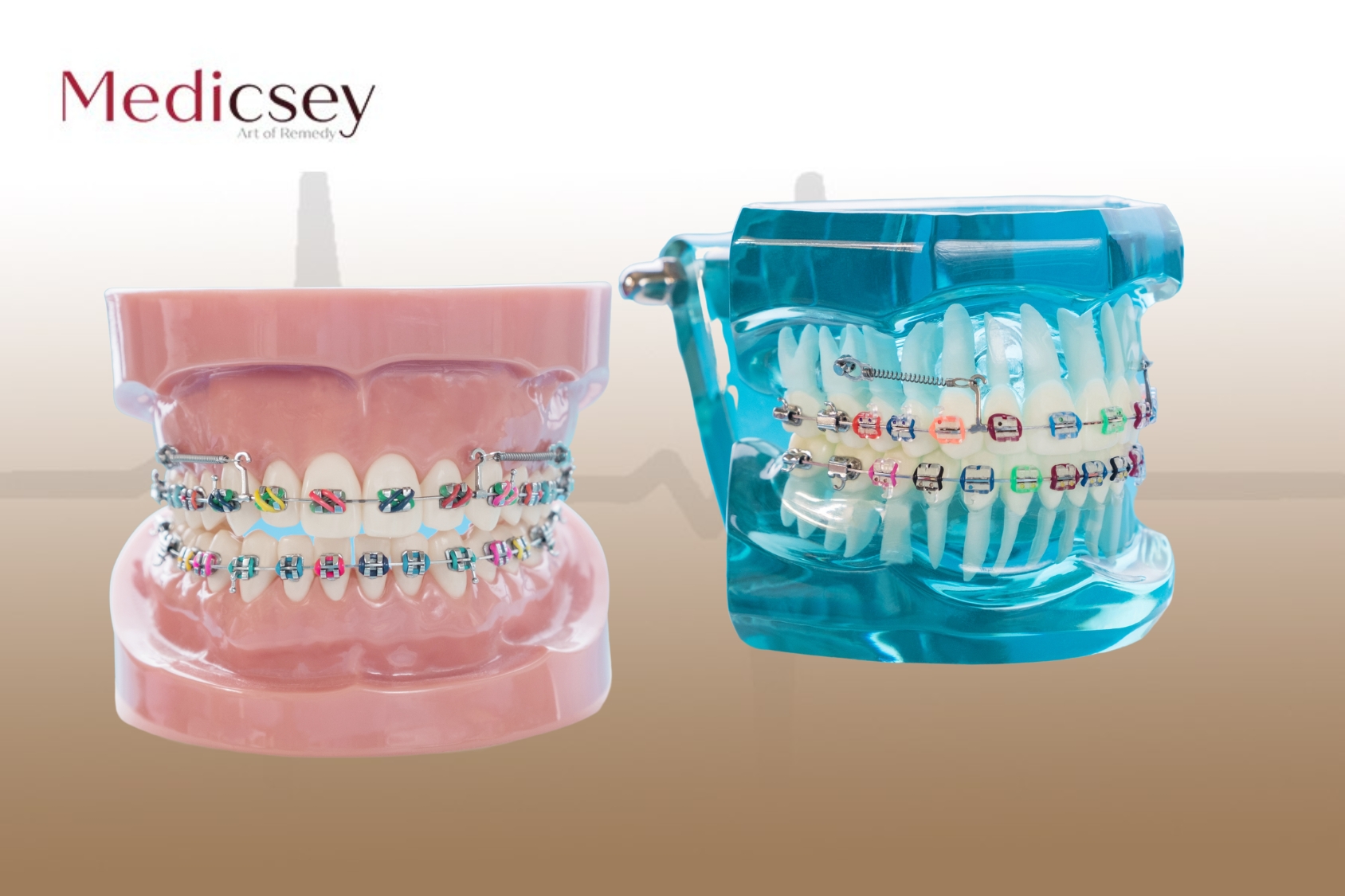 Orthodontics in Istanbul