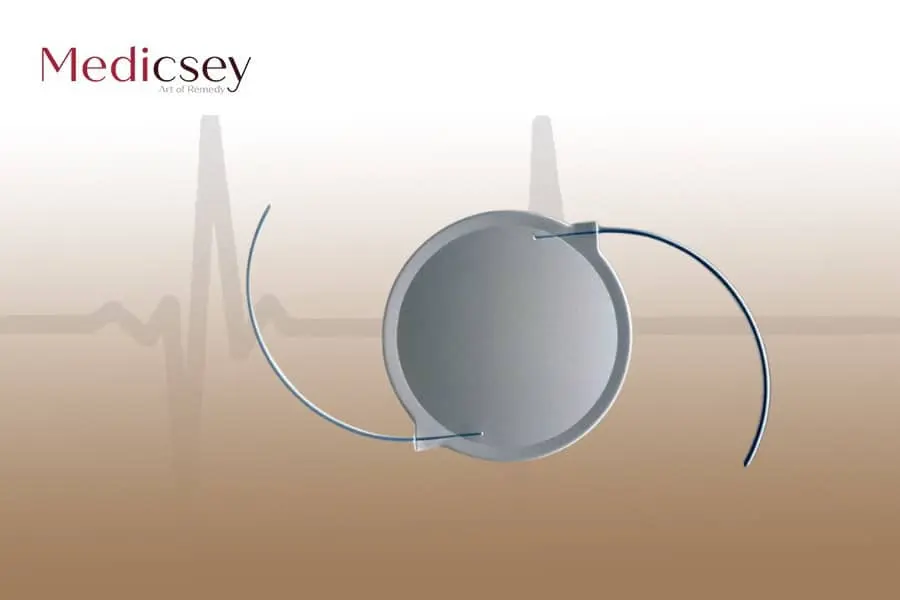 lens replacement surgery in turkey