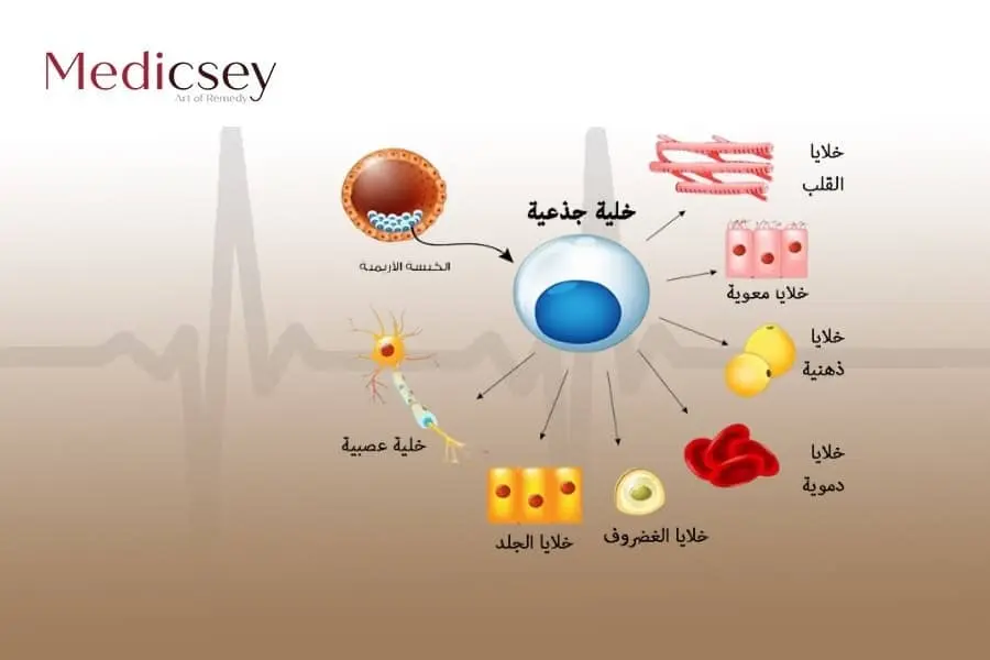 علاج العين بالخلايا الجذعية في تركيا