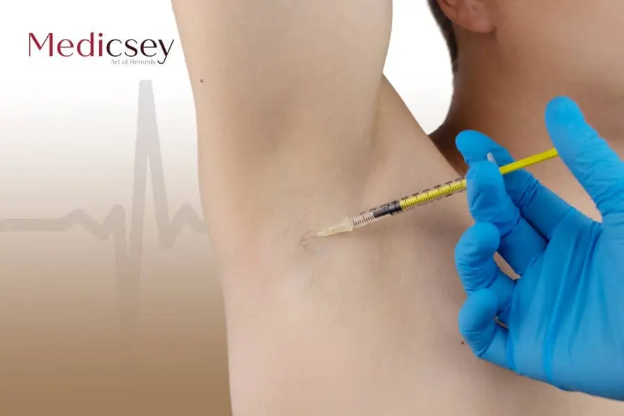 Hyperhidrosis Treatment With botox Istanbul