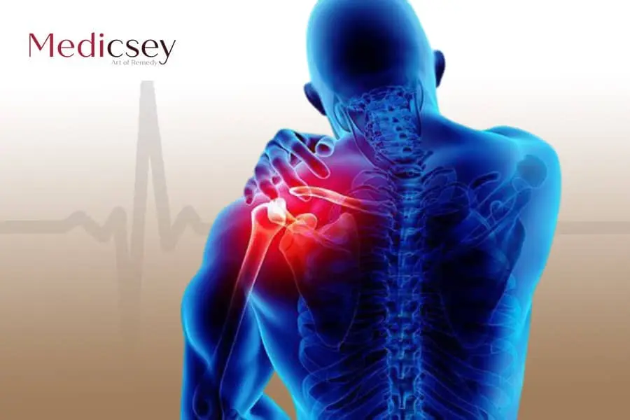 shoulder joint replacement in Turkey