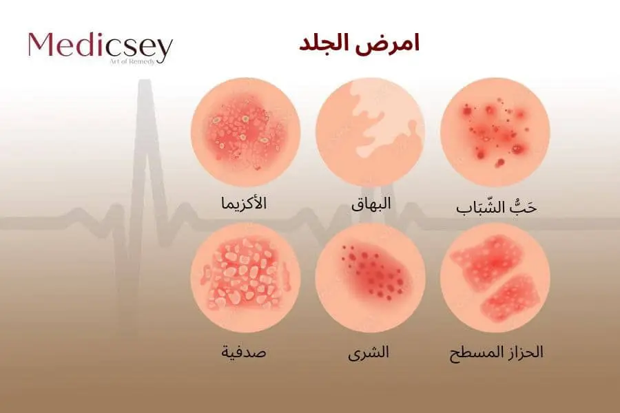 دكتور جلدية في اسطنبول