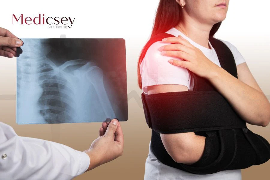 shoulder joint replacement in Turkey