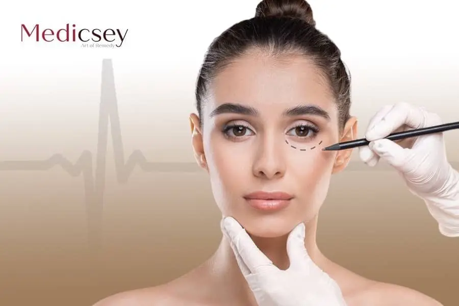 oculoplastic surgery in Turkey