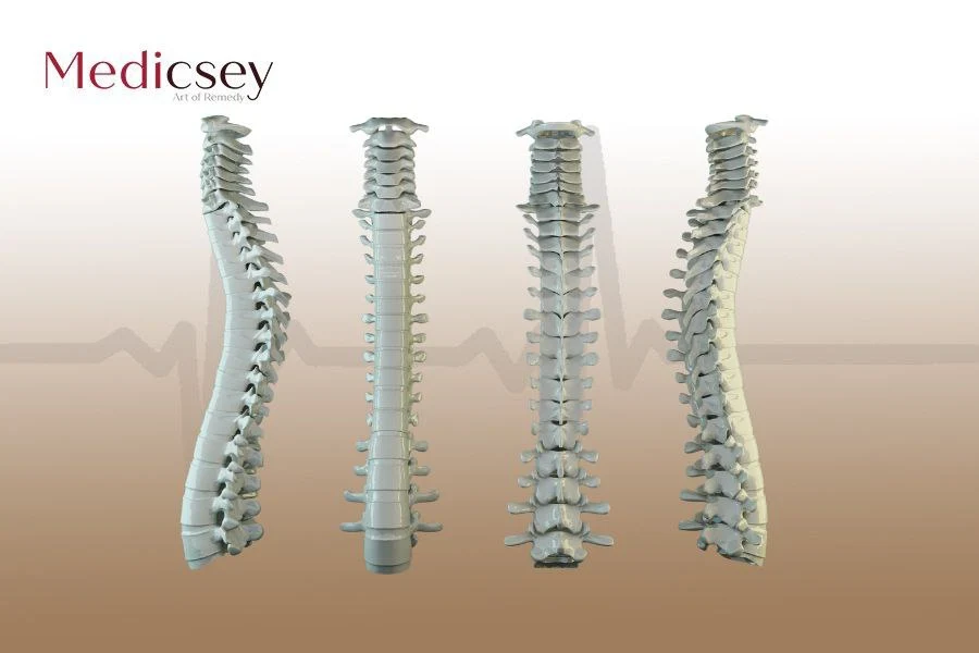 Best Spine Surgeons in Turkey