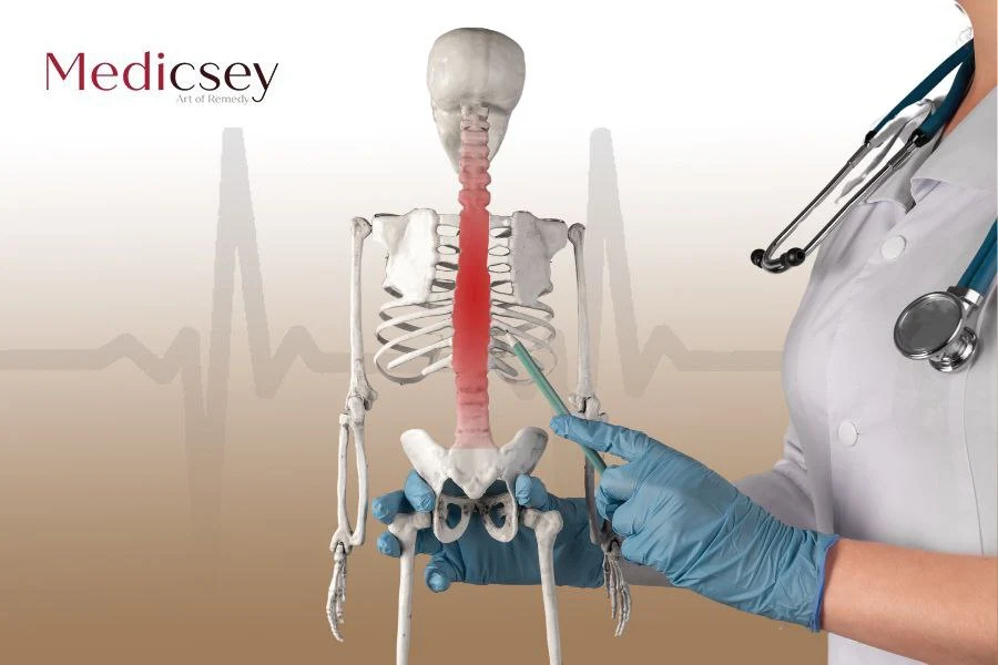 Best Spine Surgeons in Turkey