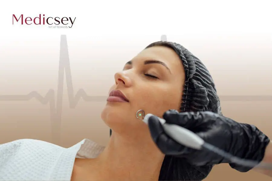 Laser Mole Removal in Istanbul, 