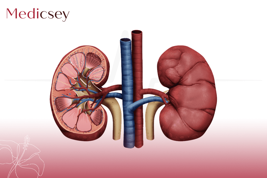 Kidney Transplant