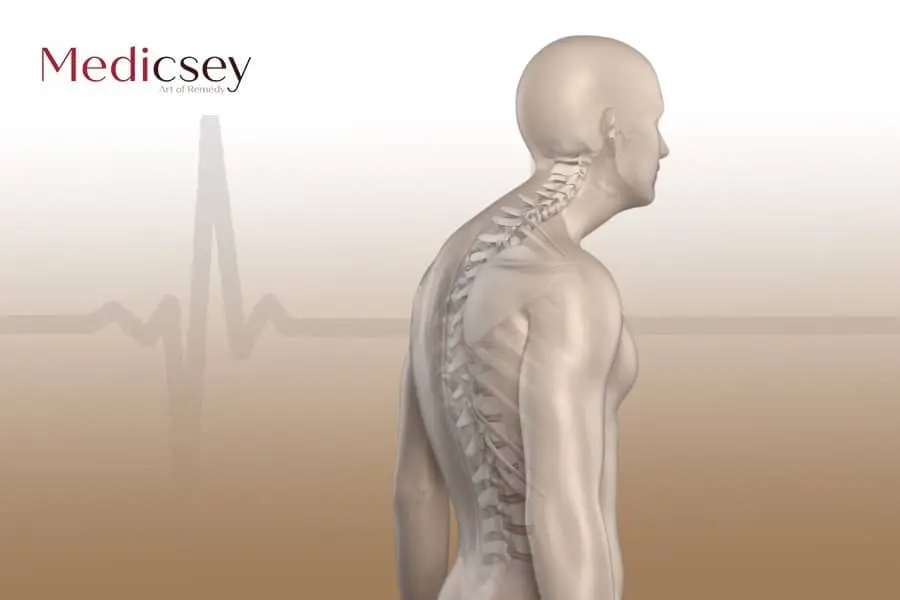 Causes and treatment of scoliosis in Turkey
