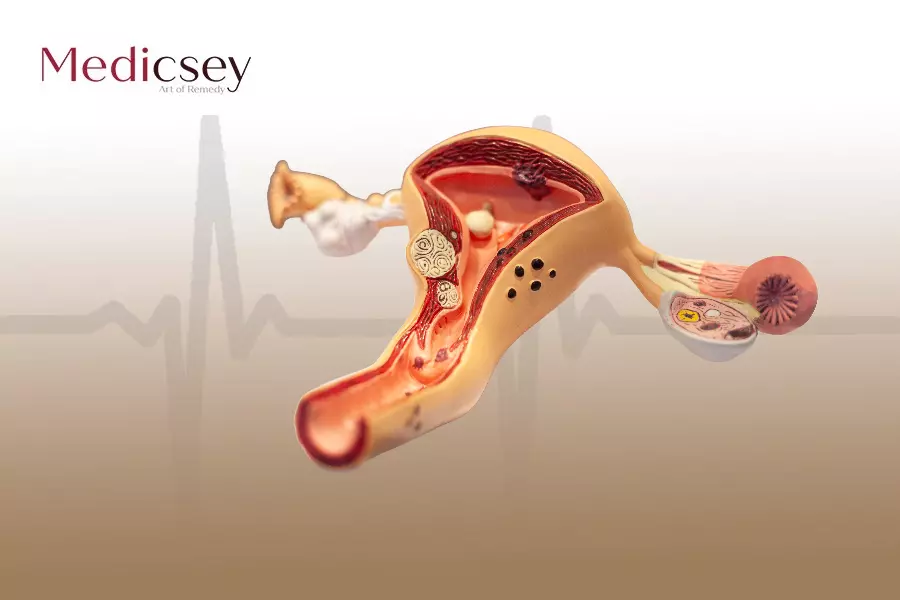 Hysteroscopy Procedure