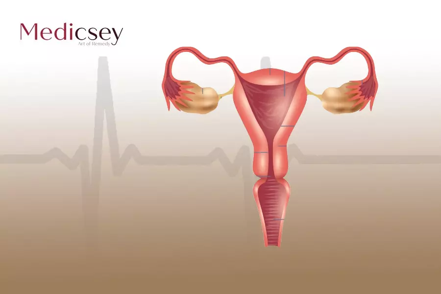 أسباب الثآليل التناسلية وعلاجها في تركيا