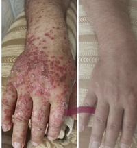 Dermatology Treatments