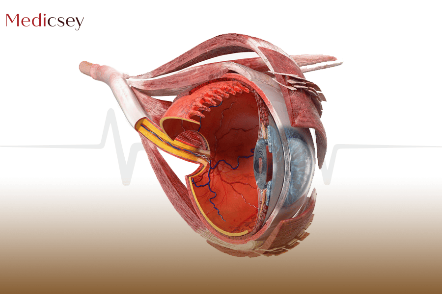 Retina treatment 