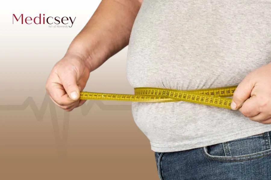 Gastric Sleeve Surgery in Istanbul: A Complete Guide